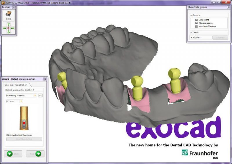 Фото ПО для стоматологии Exocad basic (голубой донгл)_1