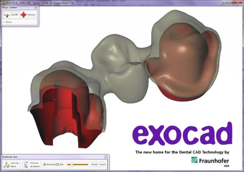 Фото ПО для стоматологии Exocad basic (голубой донгл)_2